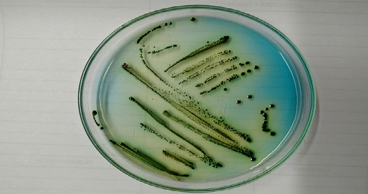 Gusanos nativos de Tumaco, aliados para combatir plagas de palma de aceite