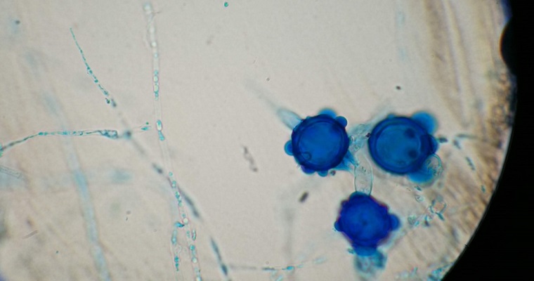 Revolucionario estudio de AGROSAVIA revela el potencial de hongos nematófagos nativos para controlar nematodos gastrointestinales en ovinos